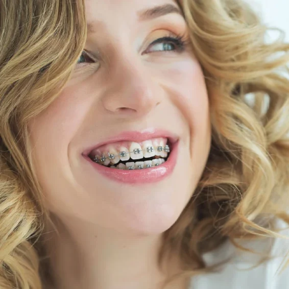 Getting Braces as an Adult in Michigan | Debunking the Myths about Adult Braces