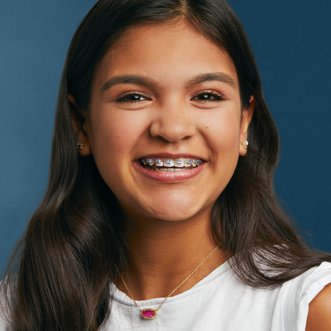 Braces Near Detroit | Traditional & Ceramic Braces for All Ages